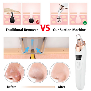 Sunction and Blackhead Remover