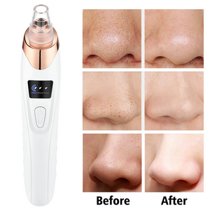 Sunction and Blackhead Remover