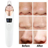 Sunction and Blackhead Remover